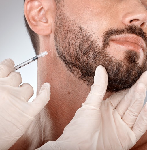 beard-hair-transplant-procedure