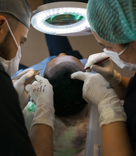 body-hair-transplant-procedure