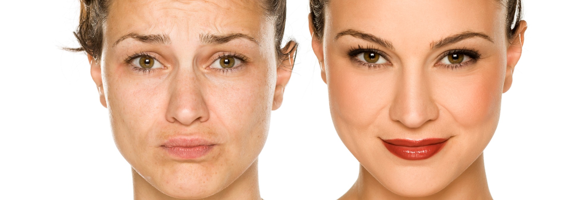 Eyebrow Hair Transplant