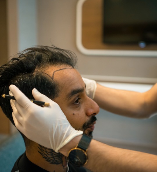 male-hair-transplant-procedure