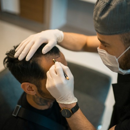 receding-hairline-reconstruction-procedure