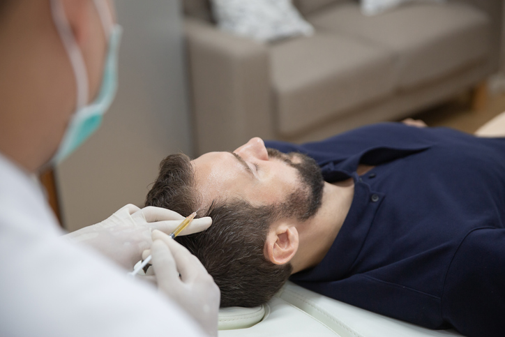 Hair Transplant Techniques for Male Hair Restoration