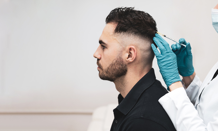Male Hair Transplant: Is It a Permanent Solution?