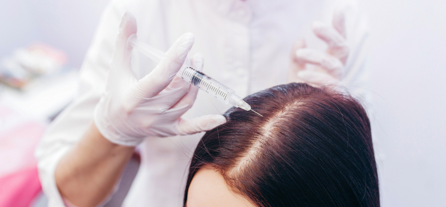 Preparing for FUE Hair Transplant Surgery: What You Need to Know