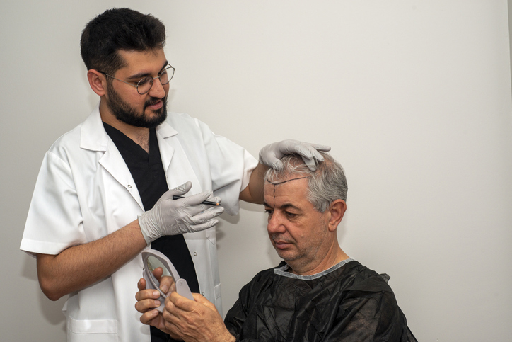The Science Behind Hair Transplantation: How It Works