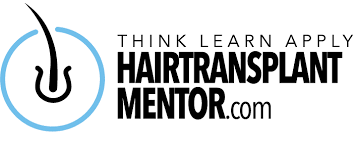 hair-transplant-mentor
