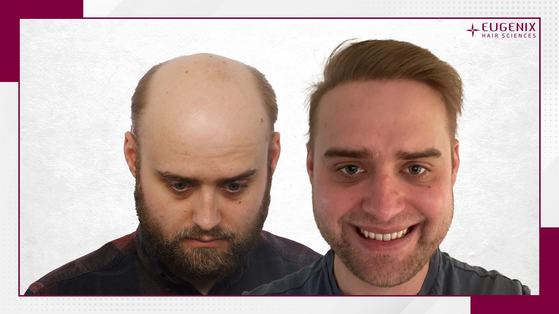 John-Cross-Before-and-After