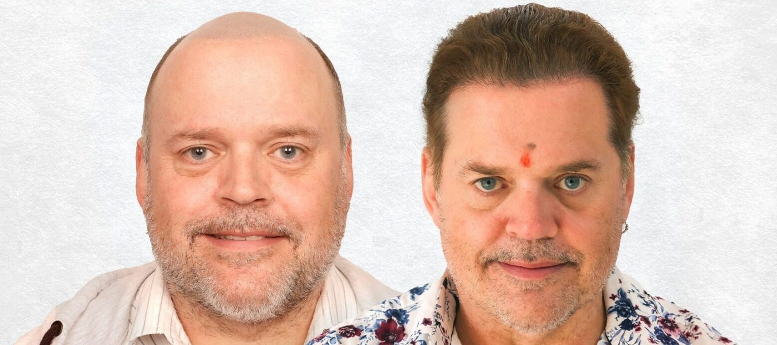 Hair Transplant: A New Dawn in the Battle Against Baldness