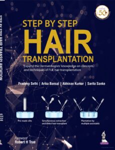 hair-transplant-book-dht-uk